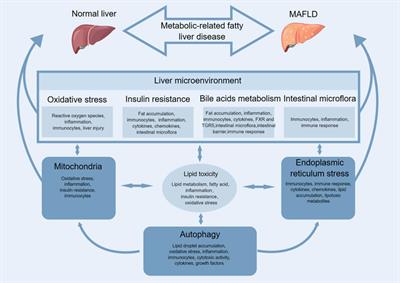 Traditional Chinese medicines and natural products targeting immune cells in the treatment of metabolic-related fatty liver disease